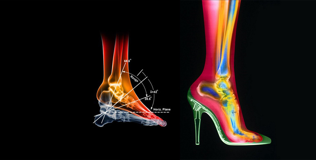 foot biomechanics -feature