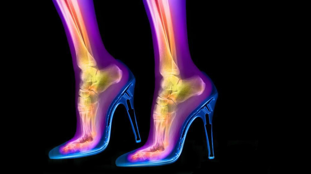 High Heels- stiletto-x-ray